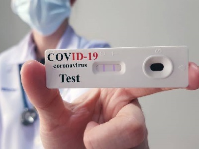 400x300 test sierologico